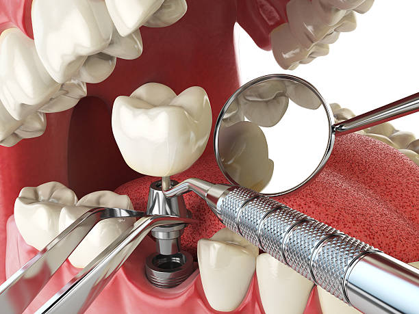 Best Weekend Emergency Dentist in Sudley, VA